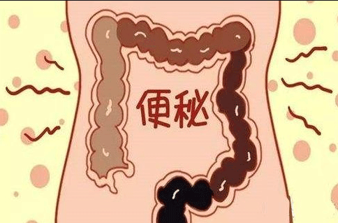 便秘患者注意：一定要吃对食物，避免病情加重！