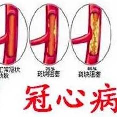泰安圣康医院的医生讲述冠心病的早期症状