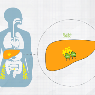 泰安养老院讲述老年人患有脂肪肝后的要如何正确的处理呢？