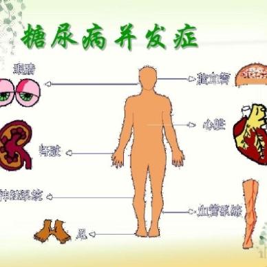 糖尿病早期症状表现都有哪些？泰安圣康医院讲解更专业