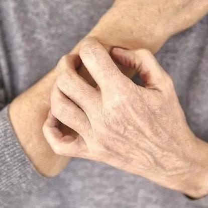 老年人身体痒的原因有哪些？泰安养老院为您讲解